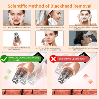 Blackhead Buster Pro