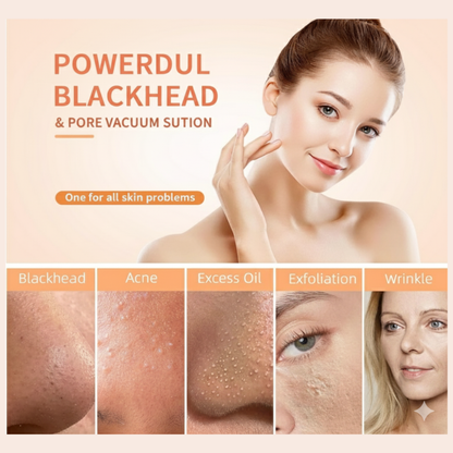 Blackhead Buster Pro