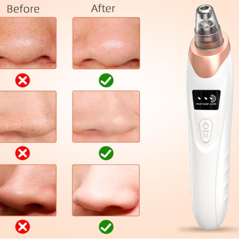 Blackhead Buster Pro